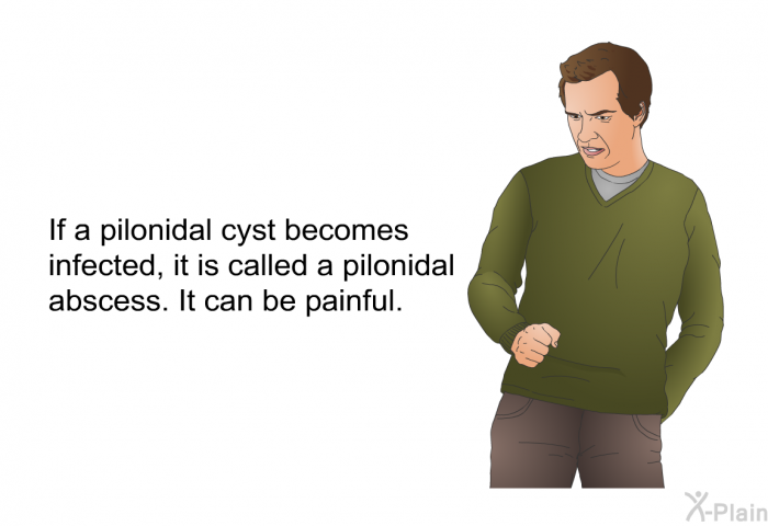 If a pilonidal cyst becomes infected, it is called a pilonidal abscess. It can be painful.