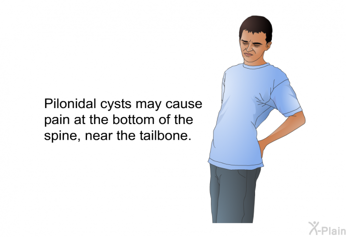 Pilonidal cysts may cause pain at the bottom of the spine, near the tailbone.