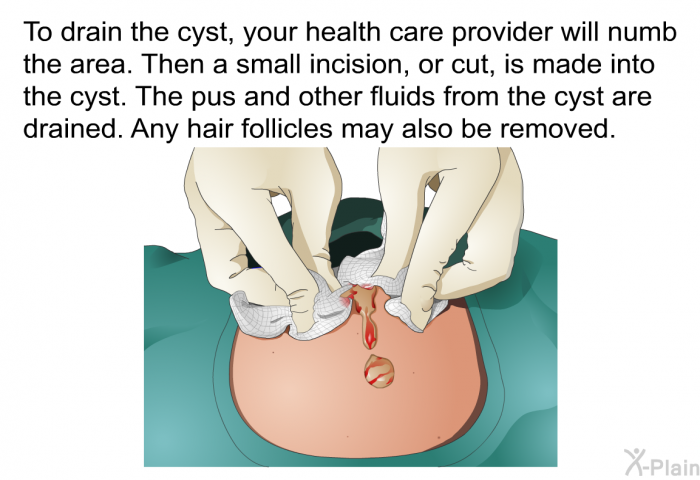 To drain the cyst, your health care provider will numb the area. Then a small incision, or cut, is made into the cyst. The pus and other fluids from the cyst are drained. Any hair follicles may also be removed.