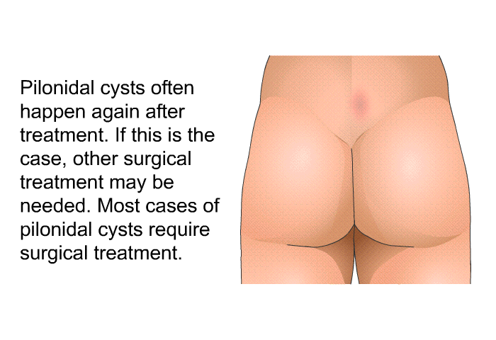 Pilonidal cysts often happen again after treatment. If this is the case, other surgical treatment may be needed. Most cases of pilonidal cysts require surgical treatment.