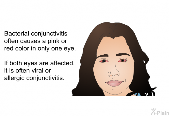 Bacterial conjunctivitis often causes a pink or red color in only one eye. If both eyes are affected, it is often viral or allergic conjunctivitis.