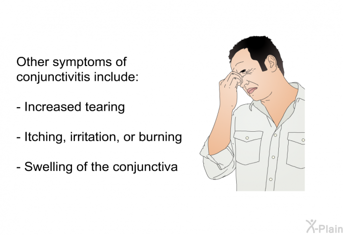 Other symptoms of conjunctivitis include:  Increased tearing Itching, irritation, or burning Swelling of the conjunctiva