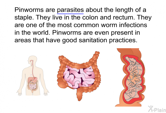 Pinworms are parasites about the length of a staple. They live in the colon and rectum. They are one of the most common worm infections in the world. Pinworms are even present in areas that have good sanitation practices.