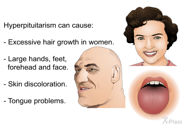 Hyperpituitarism can cause:  Excessive hair growth in women. Large hands, feet, forehead and face. Skin discoloration. Tongue problems.
