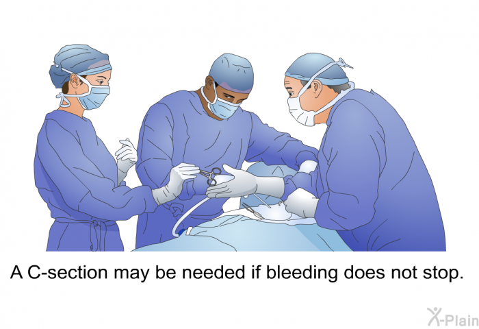 A C-section may be needed if bleeding does not stop.