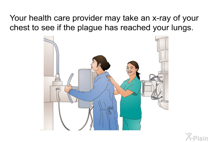 Your health care provider may take an x-ray of your chest to see if the plague has reached your lungs.