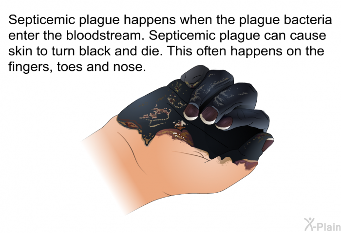 Septicemic plague happens when the plague bacteria enter the bloodstream. Septicemic plague can cause skin to turn black and die. This often happens on the fingers, toes and nose.