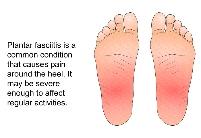 Plantar fasciitis is a common condition that causes pain around the heel. It may be severe enough to affect regular activities.