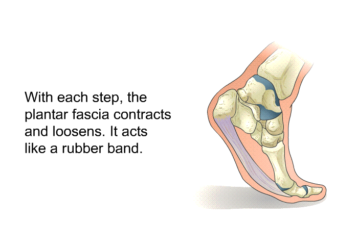 With each step, the plantar fascia contracts and loosens. It acts like a rubber band.