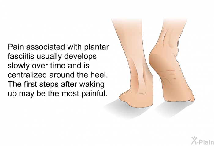 Pain associated with plantar fasciitis usually develops slowly over time and is centralized around the heel. The first steps after waking up may be the most painful.
