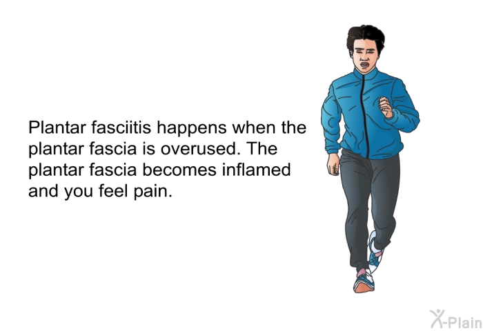 Plantar fasciitis happens when the plantar fascia is overused. The plantar fascia becomes inflamed and you feel pain.