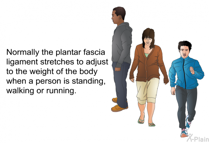 Normally the plantar fascia ligament stretches to adjust to the weight of the body when a person is standing, walking or running.