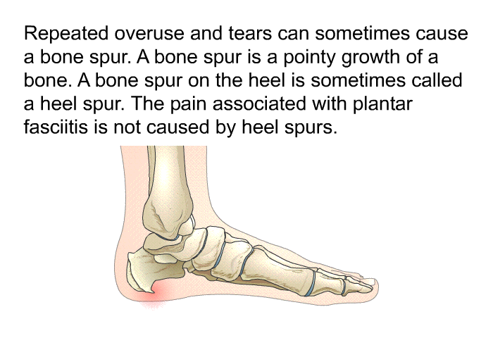 Repeated overuse and tears can sometimes cause a bone spur. A bone spur is a pointy growth of a bone. A bone spur on the heel is sometimes called a heel spur. The pain associated with plantar fasciitis is not caused by heel spurs.