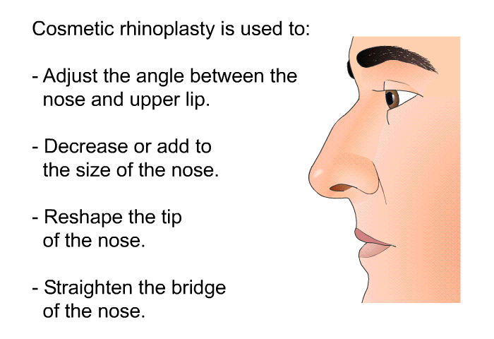 Cosmetic rhinoplasty is used to:  Adjust the angle between the nose and upper lip. Decrease or add to the size of the nose. Reshape the tip of the nose. Straighten the bridge of the nose.