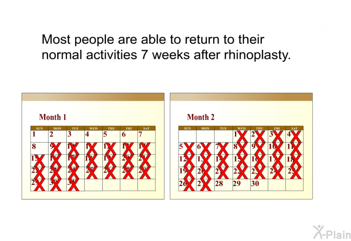 Most people are able to return to their normal activities 7 weeks after rhinoplasty.