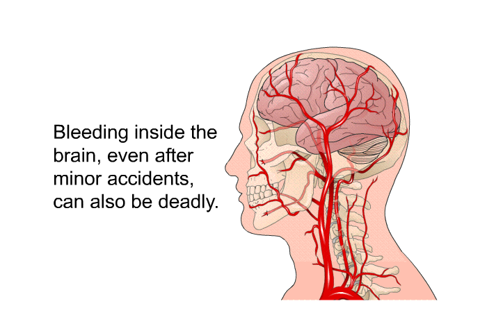 Bleeding inside the brain, even after minor accidents, can also be deadly.