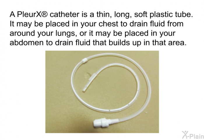 A PleurX<SUP> </SUP> catheter is a thin, long, soft plastic tube. It may be placed in your chest to drain fluid from around your lungs, or it may be placed in your abdomen to drain fluid that builds up in that area.