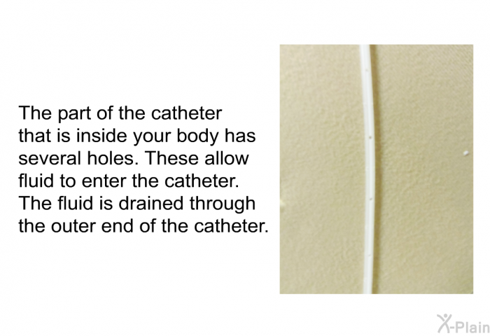 The part of the catheter that is inside your body has several holes. These allow fluid to enter the catheter. The fluid is drained through the outer end of the catheter.