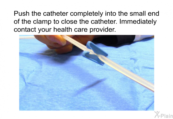 Push the catheter completely into the small end of the clamp to close the catheter. Immediately contact your health care provider.