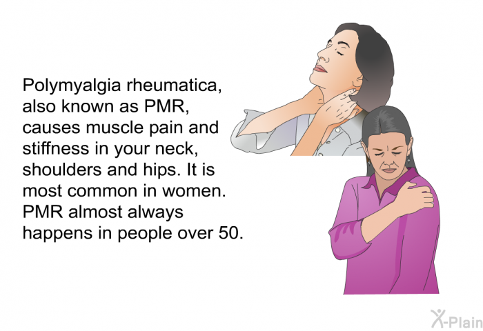 Polymyalgia rheumatica, also known as PMR, causes muscle pain and stiffness in your neck, shoulders and hips. It is most common in women. PMR almost always happens in people over 50.