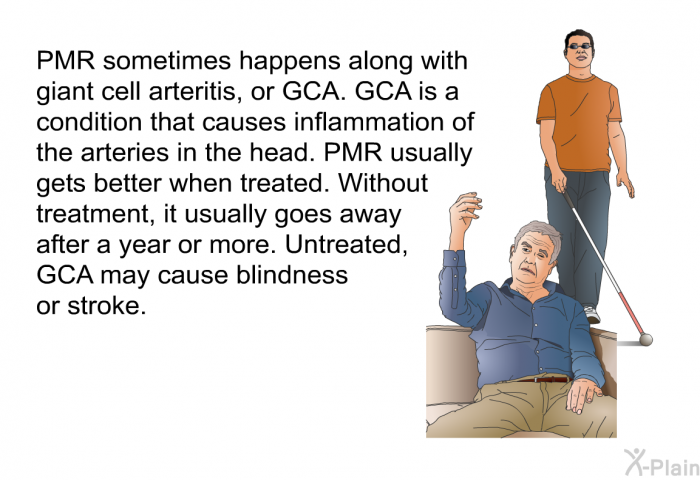 PMR sometimes happens along with giant cell arteritis, or GCA. GCA is a condition that causes inflammation of the arteries in the head. PMR usually gets better when treated. Without treatment, it usually goes away after a year or more. Untreated, GCA may cause blindness or stroke.