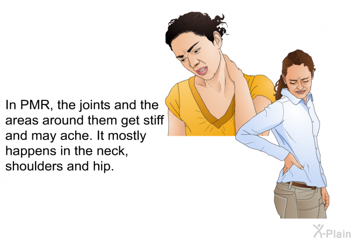 In PMR, the joints and the areas around them get stiff and may ache. It mostly happens in the neck, shoulders and hip.