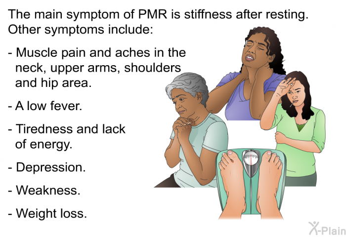 The main symptom of PMR is stiffness after resting. Other symptoms include:  Muscle pain and aches in the neck, upper arms, shoulders and hip area. A low fever. Tiredness and lack of energy. Depression. Weakness. Weight loss.