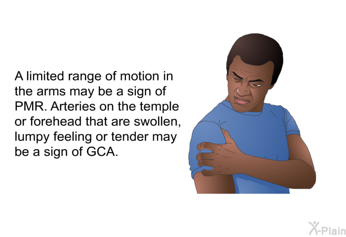 A limited range of motion in the arms may be a sign of PMR. Arteries on the temple or forehead that are swollen, lumpy feeling or tender may be a sign of GCA.