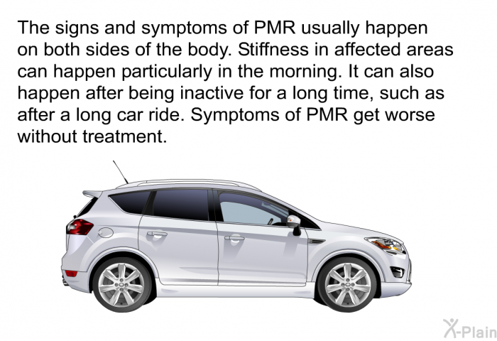 The signs and symptoms of PMR usually happen on both sides of the body. Stiffness in affected areas can happen particularly in the morning. It can also happen after being inactive for a long time, such as after a long car ride. Symptoms of PMR get worse without treatment.