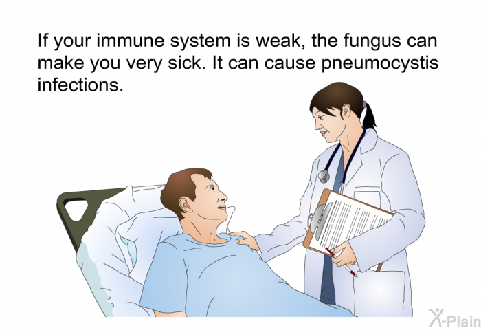 If your immune system is weak, the fungus can make you very sick. It can cause pneumocystis infections.