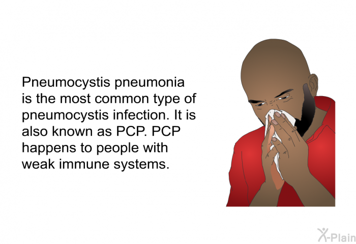 Pneumocystis pneumonia is the most common type of pneumocystis infection. It is also known as PCP. PCP happens to people with weak immune systems.