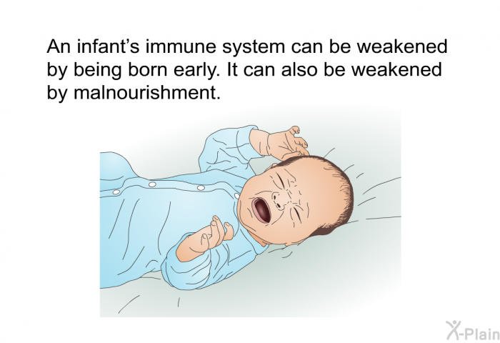 An infant’s immune system can be weakened by being born early. It can also be weakened by malnourishment.