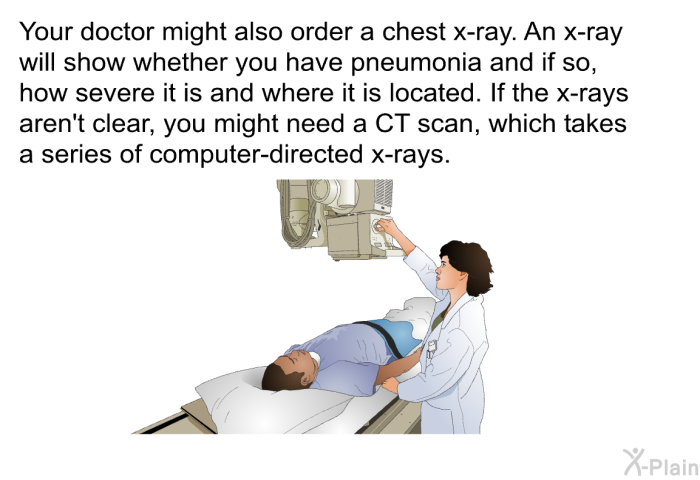 Your doctor might also order a chest x-ray. An x-ray will show whether you have pneumonia and if so, how severe it is and where it is located. If the x-rays aren't clear, you might need a CT scan, which takes a series of computer-directed x-rays.