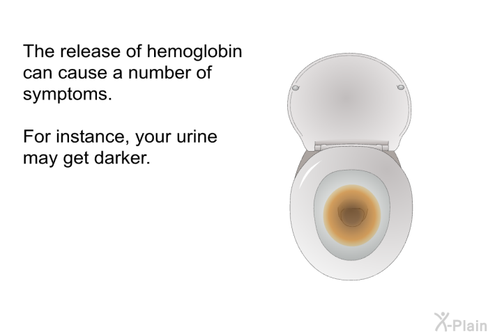 The release of hemoglobin can cause a number of symptoms. For instance, your urine may get darker.