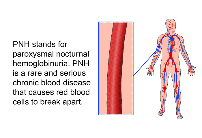 PNH stands for paroxysmal nocturnal hemoglobinuria. PNH is a rare and serious chronic blood disease that causes red blood cells to break apart.