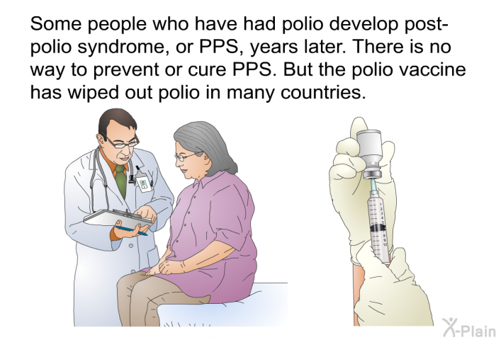 Some people who have had polio develop post-polio syndrome, or PPS, years later. There is no way to prevent or cure PPS. But the polio vaccine has wiped out polio in many countries.