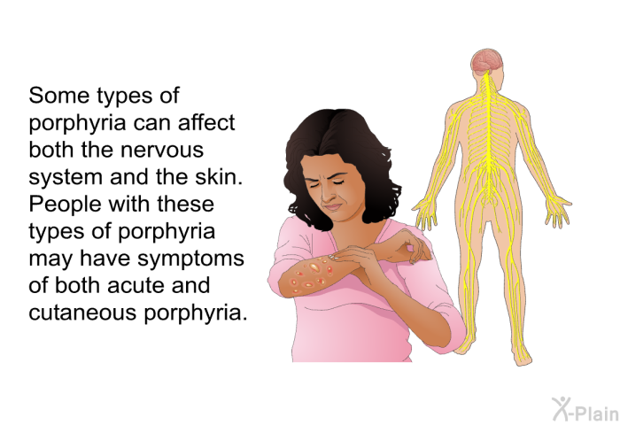 Some types of porphyria can affect both the nervous system and the skin. People with these types of porphyria may have symptoms of both acute and cutaneous porphyria.