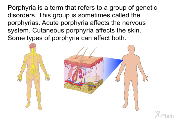 Porphyria is a term that refers to a group of genetic disorders. This group is sometimes called the porphyrias. Acute porphyria affects the nervous system. Cutaneous porphyria affects the skin. Some types of porphyria can affect both.