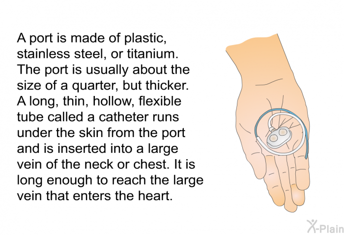 A port is made of plastic, stainless steel, or titanium. The port is usually about the size of a quarter, but thicker. A long, thin, hollow, flexible tube called a catheter runs under the skin from the port and is inserted into a large vein of the neck or chest. It is long enough to reach the large vein that enters the heart.