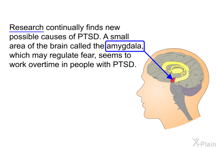 Research continually finds new possible causes of PTSD. A small area of the brain called the amygdala, which may regulate fear, seems to work overtime in people with PTSD.