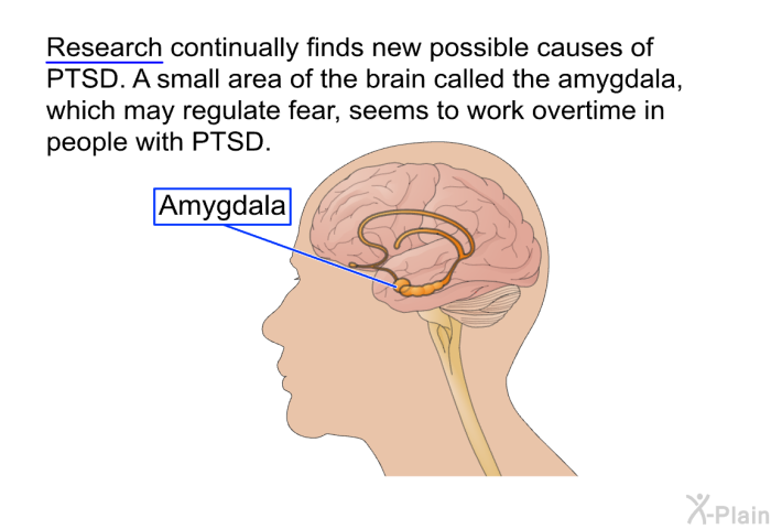 Research continually finds new possible causes of PTSD. A small area of the brain called the amygdala, which may regulate fear, seems to work overtime in people with PTSD.