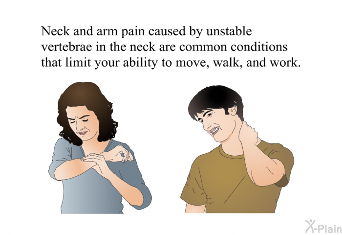 Neck and arm pain caused by unstable vertebrae in the neck are common conditions that limit your ability to move, walk, and work.