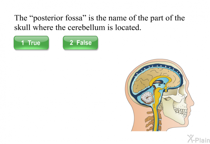 The “posterior fossa” is the name of the part of the skull where the cerebellum is located. Select True or False.