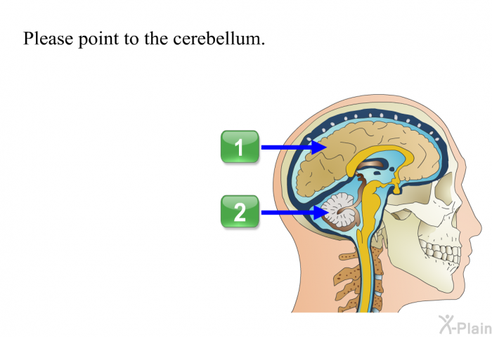 Please point to the cerebellum. Choose one of the following options.