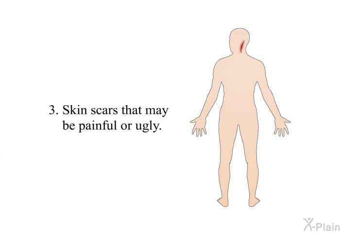 Skin scars that may be painful or ugly.