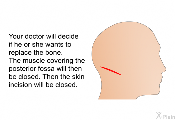 Your doctor will decide if he or she wants to replace the bone. The muscle covering the posterior fossa will then be closed. Then the skin incision will be closed.