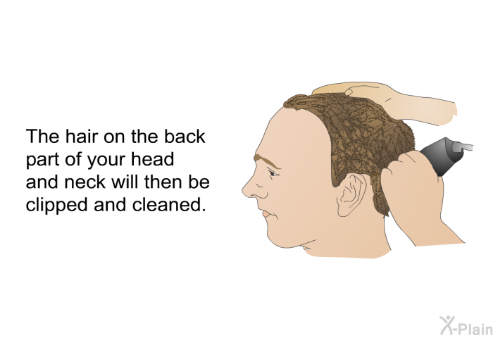 The hair on the back part of your head and neck will then be clipped and cleaned.