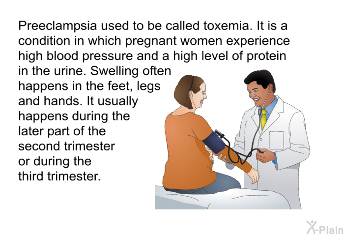 Preeclampsia used to be called toxemia. It is a condition in which pregnant women experience high blood pressure and a high level of protein in the urine. Swelling often happens in the feet, legs and hands. It usually happens during the later part of the second trimester or during the third trimester.