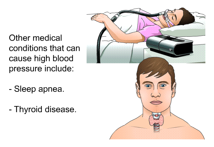 Other medical conditions that can cause high blood pressure include:  Sleep apnea. Thyroid disease.