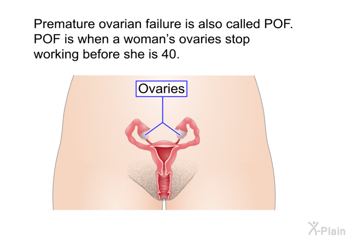 Premature ovarian failure is also called POF. POF is when a woman's ovaries stop working before she is 40.
